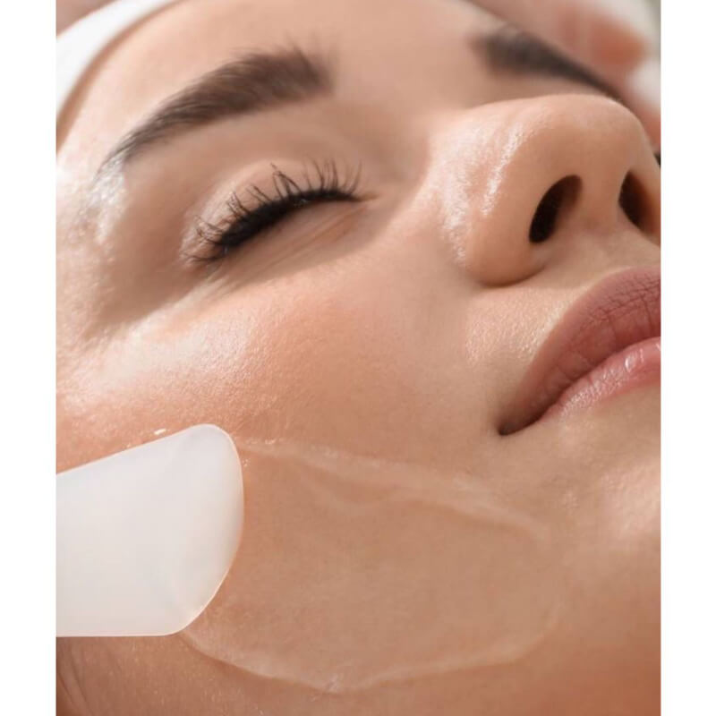 TRATAMIENTO PEELING AGUA SKIN