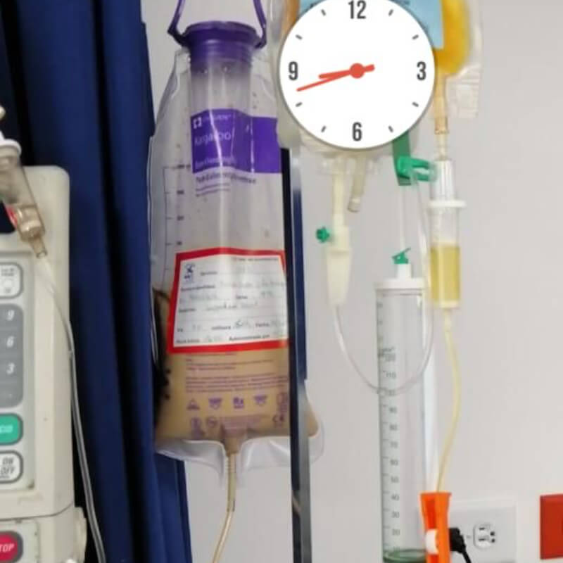 Soporte Nutricional (Enteral - Parenteral)